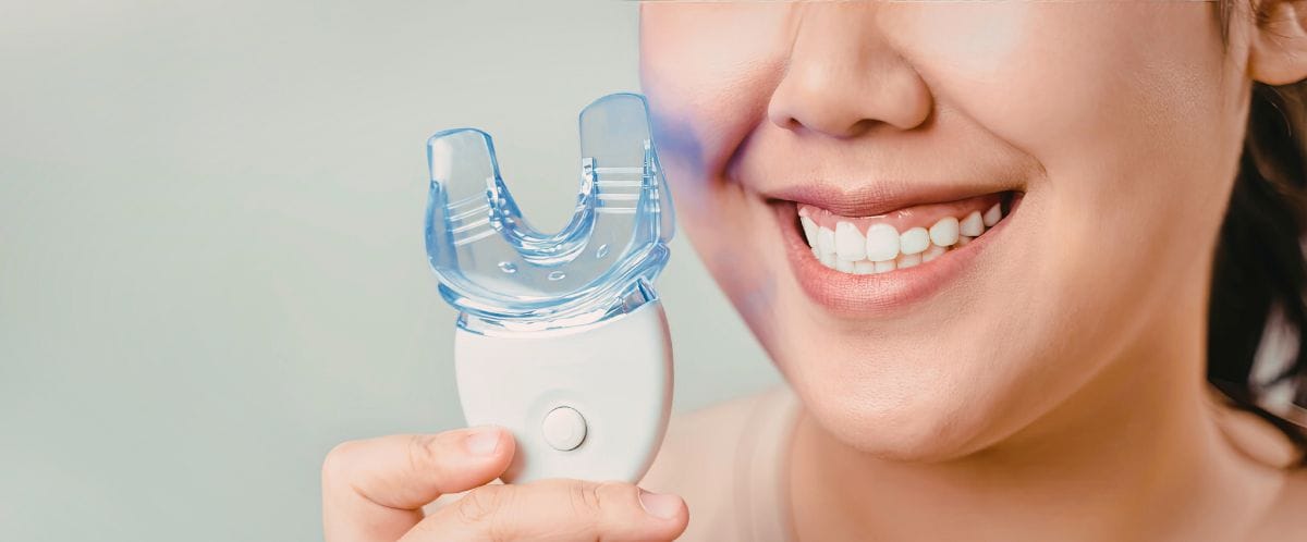 storitve beljenjezob2