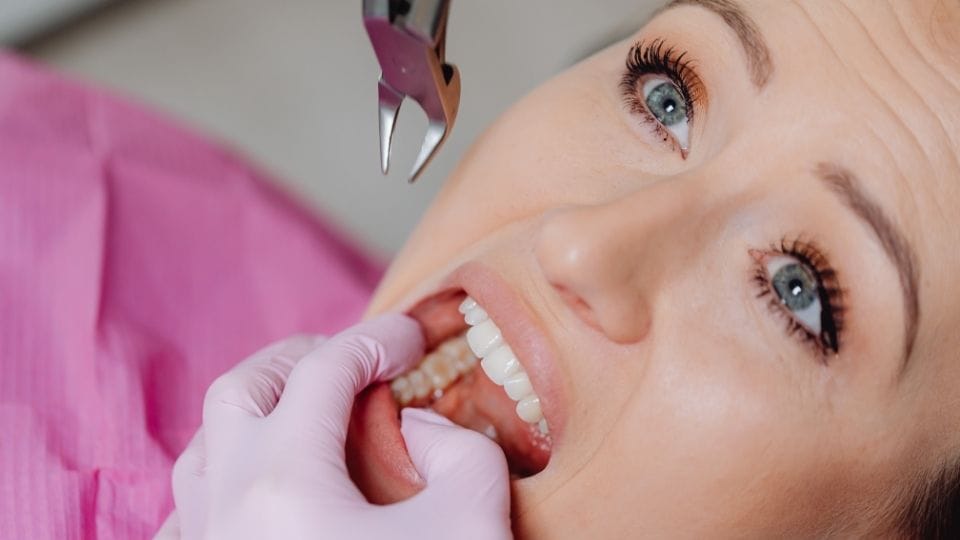 storitve oralnakirurgija1