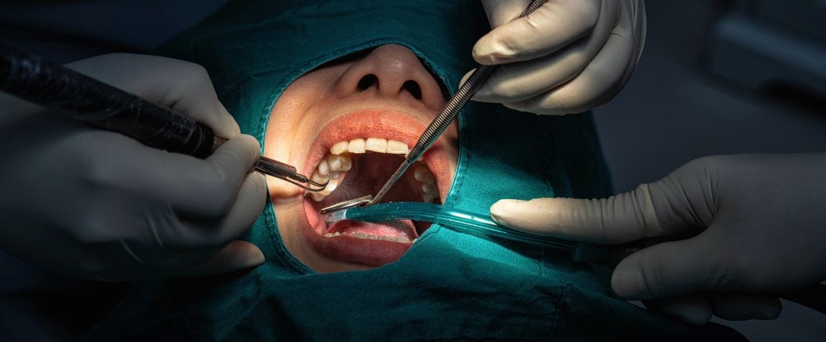 storitve oralnakirurgija2