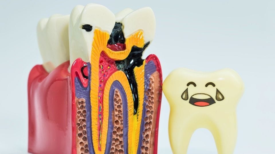 storitve sanacijakariesa1