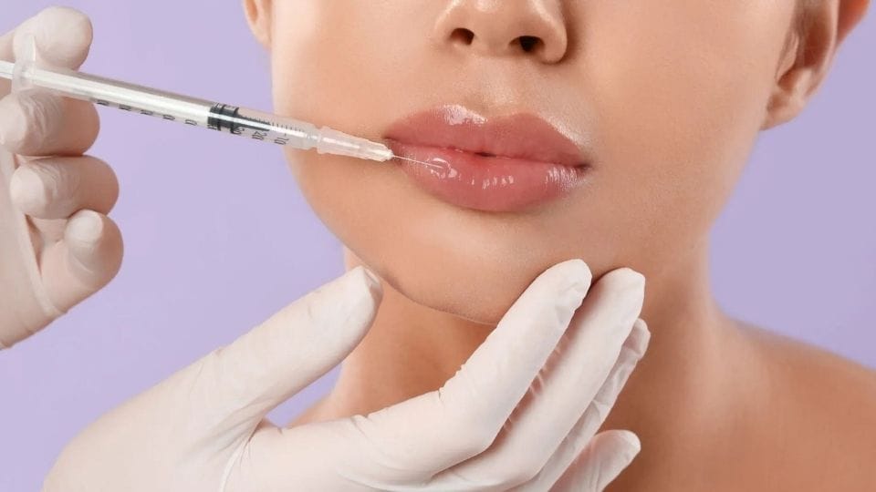 storitve ustnifilerji1