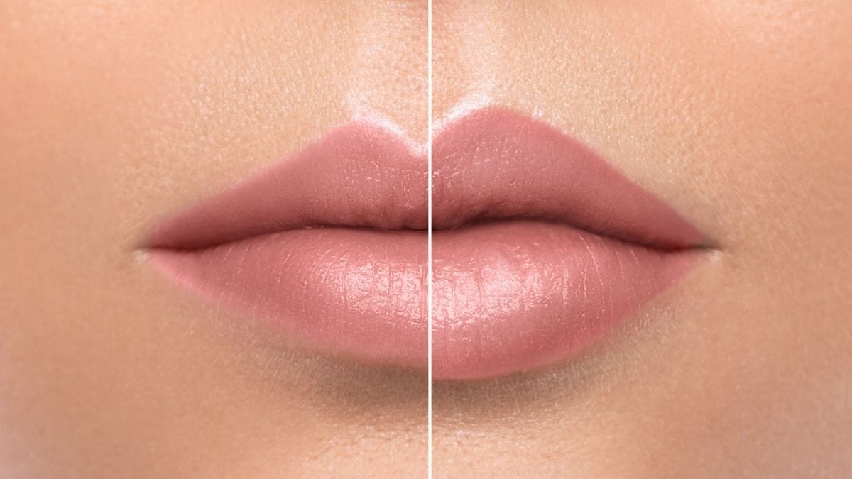 storitve ustnifilerji2