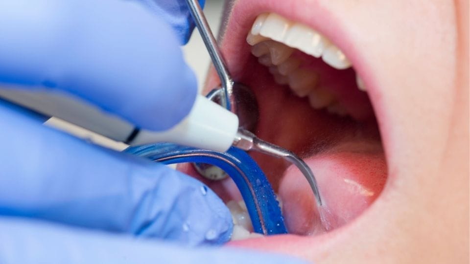 storitve zobnikamen1