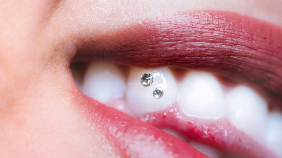 storitve zobninakit1