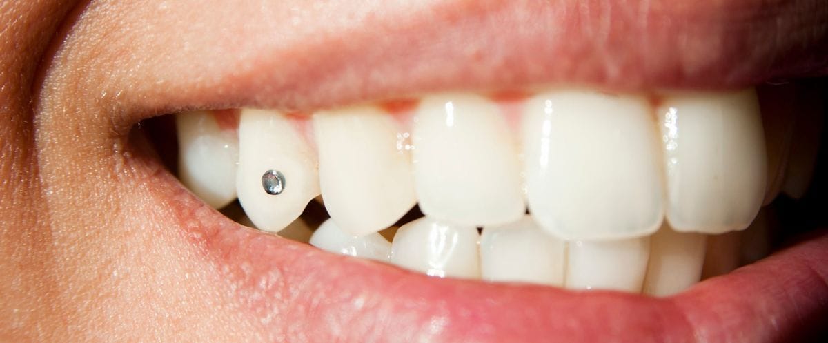 storitve zobninakit2